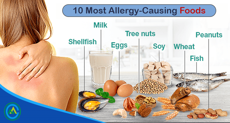 Common Causes And Treatments Of Food Allergies Life Bridge Health And 